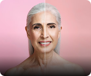 Aging skin